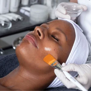 Upper Lip Bleaching
